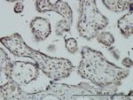 RBM9 Antibody in Immunohistochemistry (Paraffin) (IHC (P))