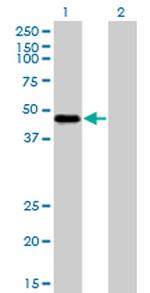 RBM9 Antibody in Western Blot (WB)