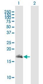 SNAPIN Antibody in Western Blot (WB)