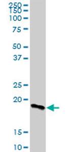 ARL2BP Antibody in Western Blot (WB)