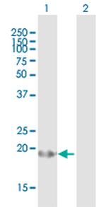 ARL2BP Antibody in Western Blot (WB)