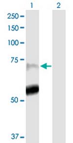 PADI4 Antibody in Western Blot (WB)