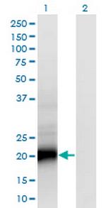 SMUG1 Antibody in Western Blot (WB)