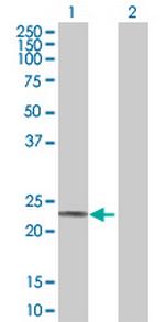 ACOT9 Antibody in Western Blot (WB)