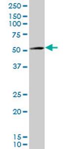 AMACR Antibody in Western Blot (WB)