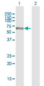 POLA2 Antibody in Western Blot (WB)