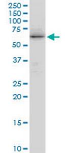 TRIM29 Antibody in Western Blot (WB)