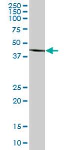 BHMT2 Antibody in Western Blot (WB)