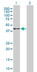 BHMT2 Antibody in Western Blot (WB)