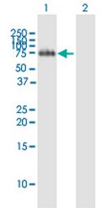 FLRT2 Antibody in Western Blot (WB)