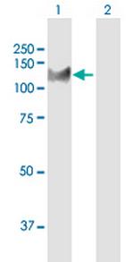 KIF4A Antibody in Western Blot (WB)