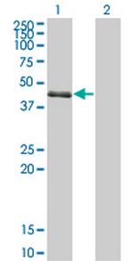 SPDEF Antibody in Western Blot (WB)