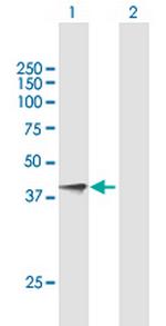 KLK5 Antibody in Western Blot (WB)