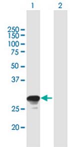 RAB26 Antibody in Western Blot (WB)