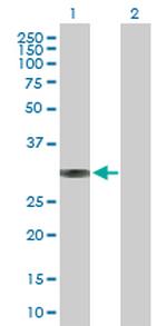 BRMS1 Antibody in Western Blot (WB)