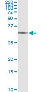 BRMS1 Antibody in Immunoprecipitation (IP)