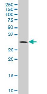 BRMS1 Antibody in Western Blot (WB)