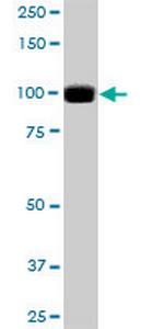 PRKD2 Antibody in Western Blot (WB)