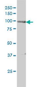 PRKD2 Antibody in Western Blot (WB)