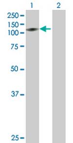 ZNF473 Antibody in Western Blot (WB)