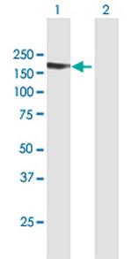 ABI3BP Antibody in Western Blot (WB)