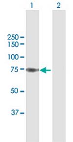 SAMHD1 Antibody in Western Blot (WB)