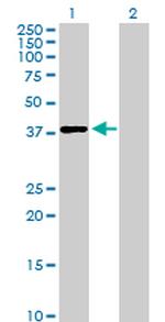 LRRC54 Antibody in Western Blot (WB)