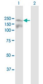 IBTK Antibody in Western Blot (WB)