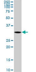 DECR2 Antibody in Western Blot (WB)