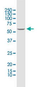 PRPF31 Antibody in Western Blot (WB)