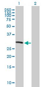 KIF26A Antibody in Western Blot (WB)