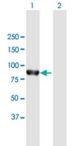 PTPN22 Antibody in Western Blot (WB)