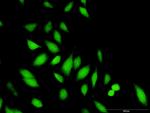 STAP1 Antibody in Immunocytochemistry (ICC/IF)