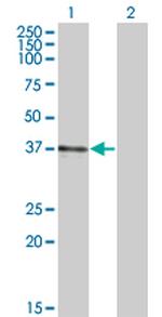 B3GAT3 Antibody in Western Blot (WB)