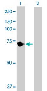 VPS33B Antibody in Western Blot (WB)