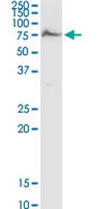 AK5 Antibody in Western Blot (WB)