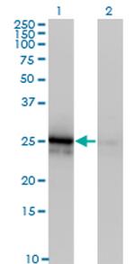 FGF21 Antibody in Western Blot (WB)