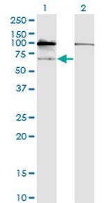 GNL3 Antibody in Western Blot (WB)