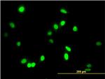 AATF Antibody in Immunocytochemistry (ICC/IF)