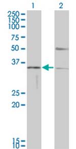 HAVCR1 Antibody in Western Blot (WB)