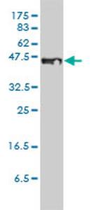 STEAP1 Antibody in Western Blot (WB)