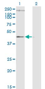 STEAP1 Antibody in Western Blot (WB)