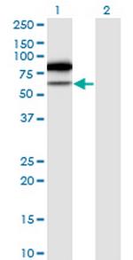 TRMT2A Antibody in Western Blot (WB)