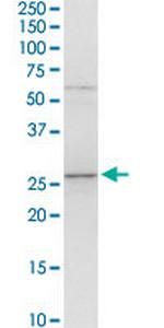 B3GAT1 Antibody in Western Blot (WB)