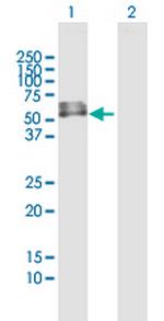 INTU Antibody in Western Blot (WB)