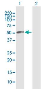 VPS4A Antibody in Western Blot (WB)