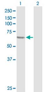 SESN1 Antibody in Western Blot (WB)