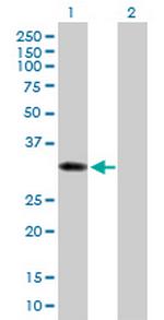 SULT1B1 Antibody in Western Blot (WB)