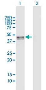 SMPDL3B Antibody in Western Blot (WB)