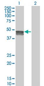 SMPDL3B Antibody in Western Blot (WB)